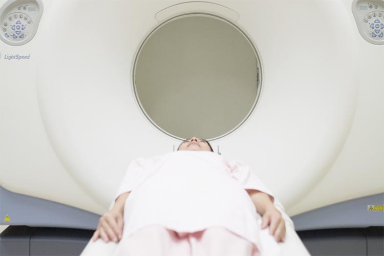 大腸CT検査のイメージ