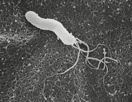 ピロリ菌の写真